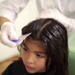 lice treatment san antonio